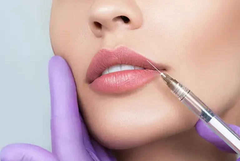 Kiss ‘Duck Lips’ Goodbye: The Secret to Natural-Looking Lip Fillers in 2025 Kiss 'Duck Lips' Goodbye The Secret to Natural-Looking Lip Fillers in 2025