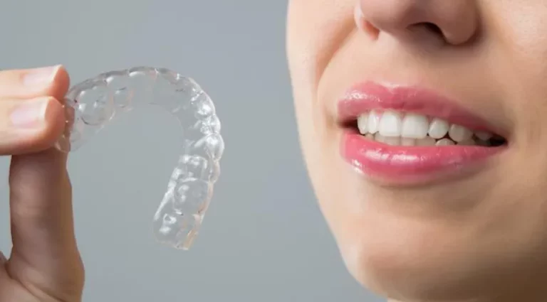 How Invisalign Aligners Improve Oral Health Beyond Straight Teeth in Kitchener